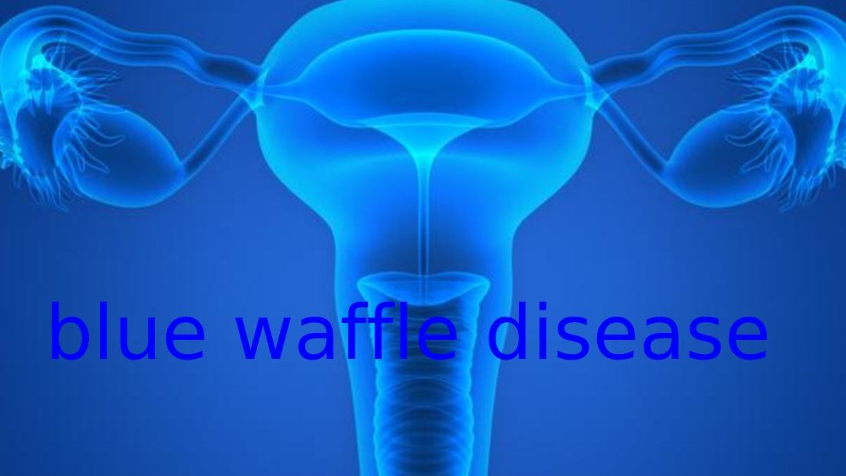 blue waffle disease picture twitter