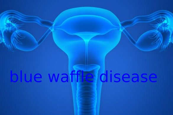 blue waffle disease picture twitter